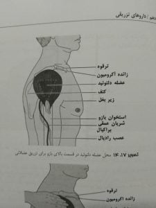 محل تزریق عضلانی در عضله دلتوئید (روش های پرستاری بالینی)