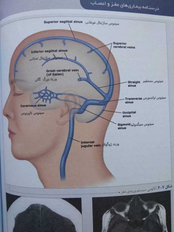 آناتومی سیستم وریدی مغز