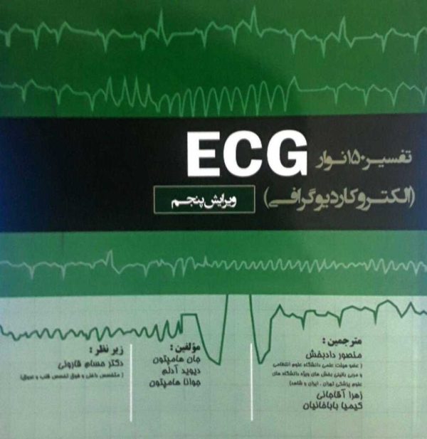 تفسیر 150 نوار ECG