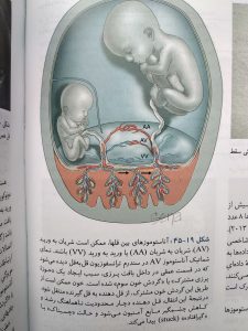 آناستوموز های بین قل ها ( بارداری و زایمان ویلیامز جلد سوم )