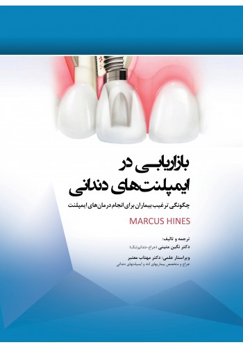 بازاریابی در ایمپلنت های دندانی