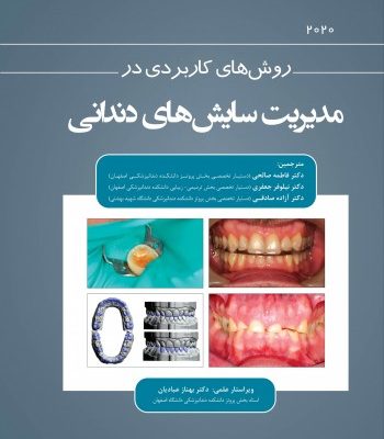 روش های کاربردی در مدیریت سایش های دندانی 2020