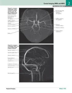 نمونه تصویر MRI از کتاب اطلس نتر| مد اسمارت